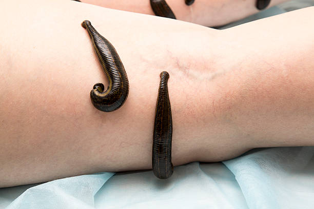 Meaning of Dreaming About Being Bitten by a Leech